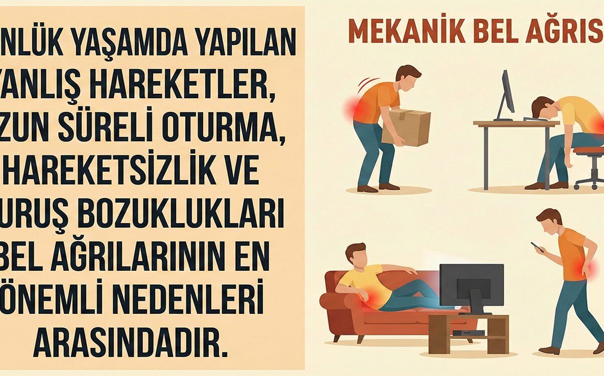 mekanik-bel-agrisi
